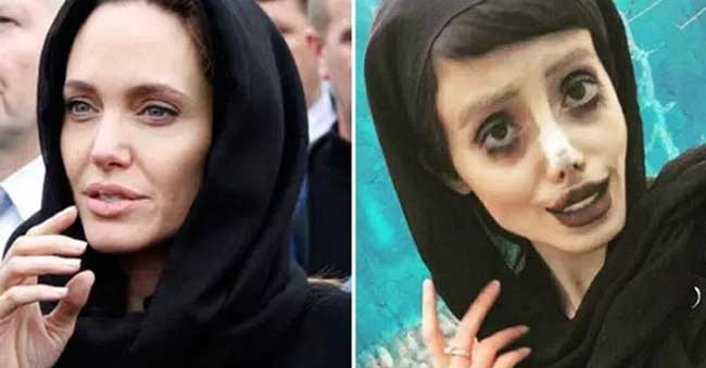Teenager undergoes 50 surgeries to look like ‘Angelina Jolie