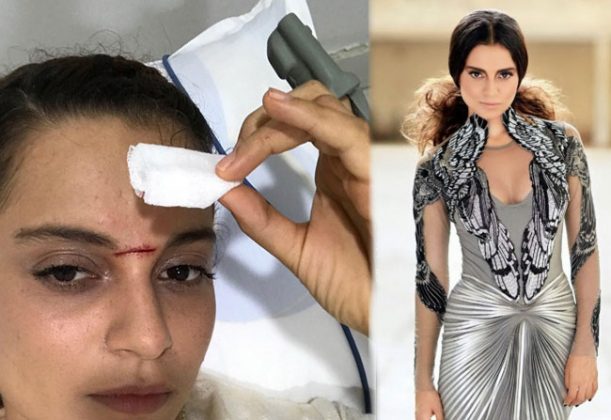 Manikarnika Get Wounded