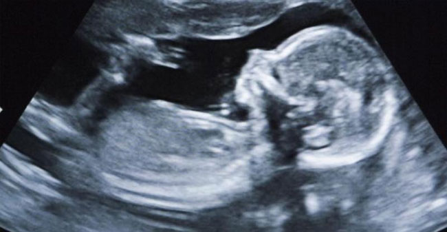 baby found in woman’s stomach after 15 years