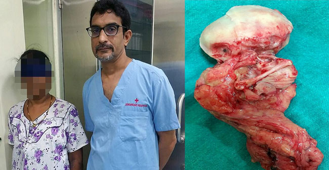 Baby found in woman’s stomach after 15 years