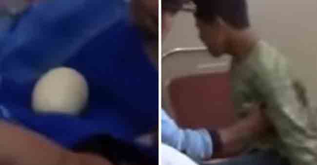 The Boy Lays Eggs In Front Of The Doctors! Baffles Everyone!