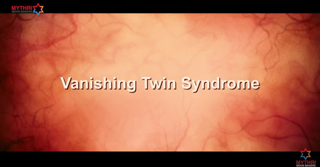 vanishing-twin-syndrome