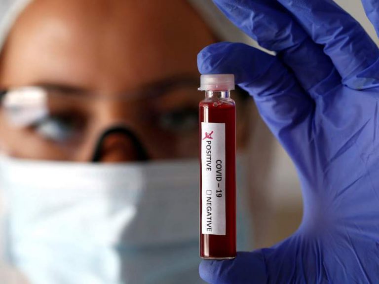 Telangana to conduct 50,000 Covid tests in 10 days