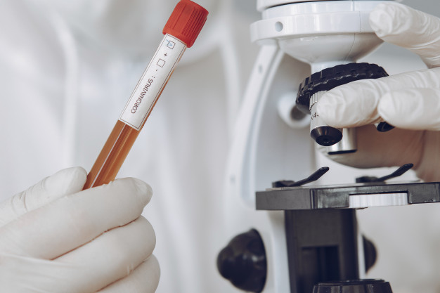 Karnataka to step up random Covid testing in specific groups