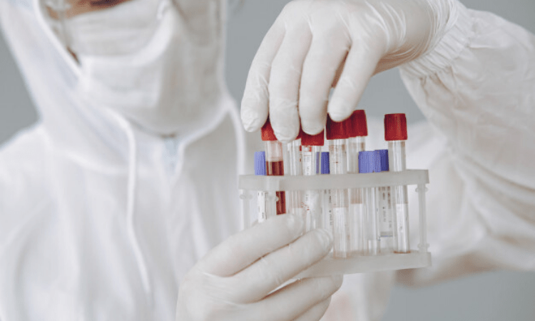 FDA issues mergency use authorization for COVID-19 antigen diagnostic test