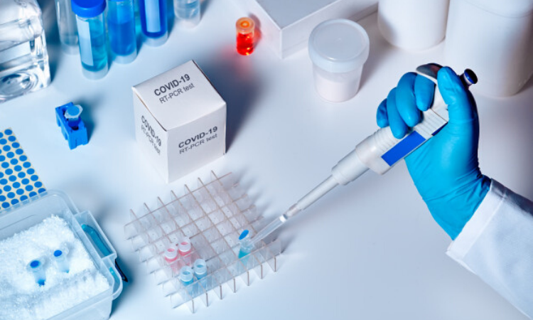 UP gets 50,000 antigen test kits for critical districts