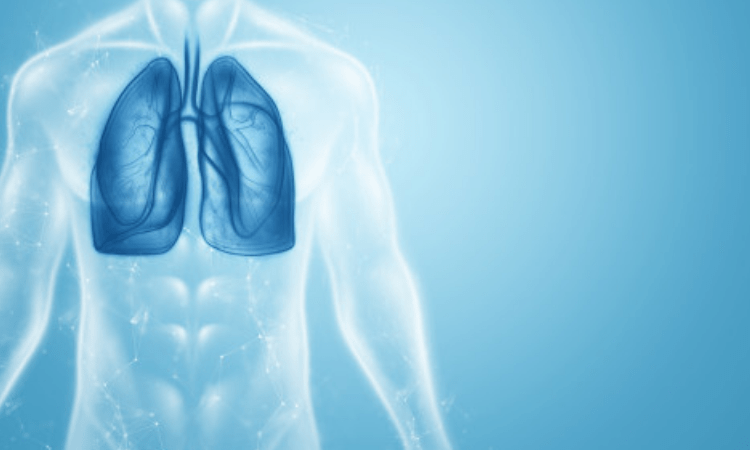 AstraZeneca, Qure.ai to bring AI solutions to detect lung cancer