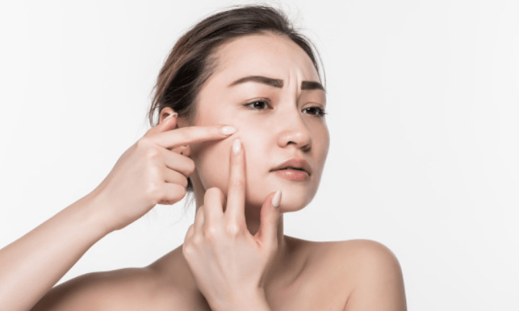 How stress impacts skin
