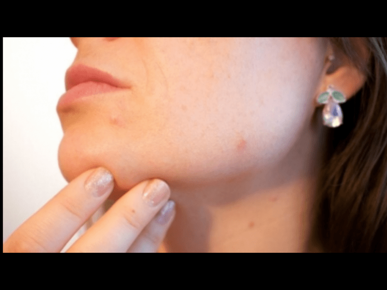 skin problems