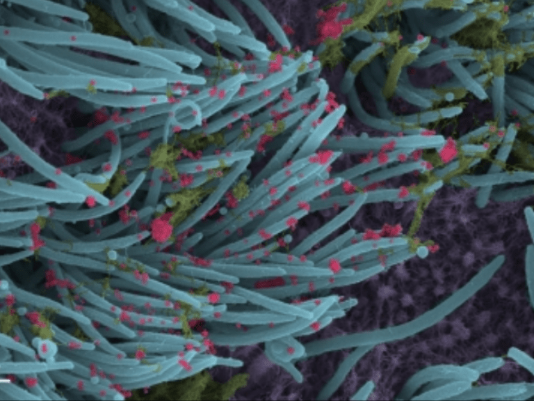 This human molecule is helping Covid virus escape antibodies