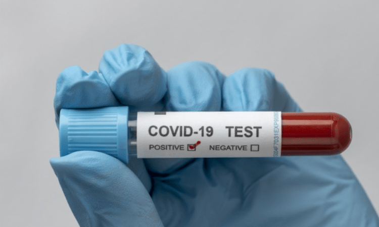 Govt invites applications to develop products for Covid