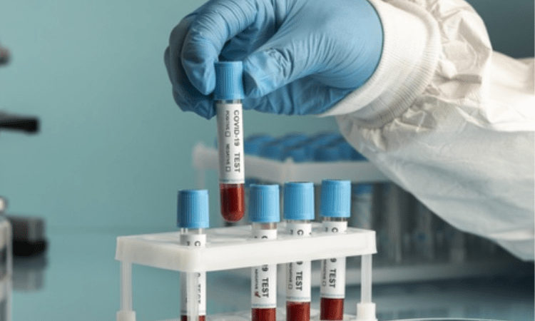 New Covid cases drop below 10K-mark in Karnataka