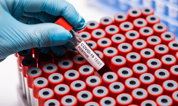 Irregularities seen in blood of long Covid patients