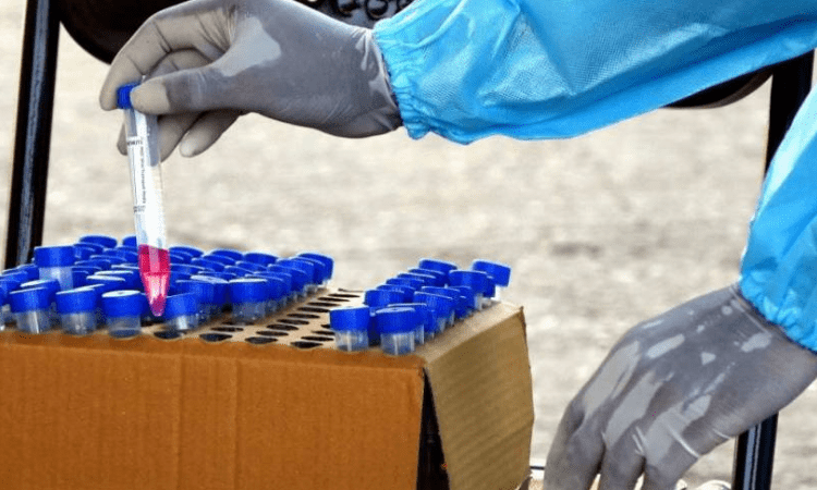 Novel device to diagnose Covid from saliva samples