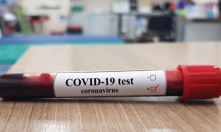 South Korea’s Covid self-test kit gets FDA emergency approval