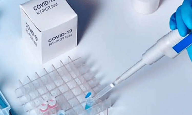 Delhi govt reduces rate of RT-PCR, RAT test by pvt labs