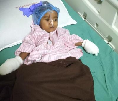 bihar child undergoes successful surgery, parents thank sonu sood