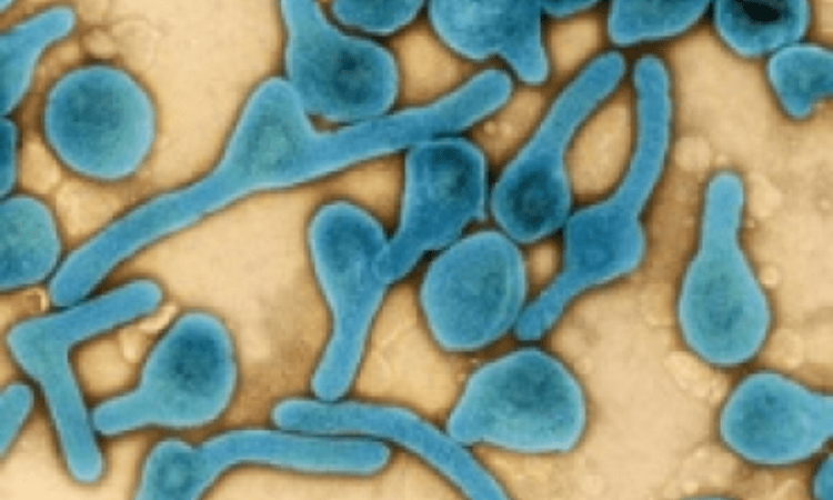 Ghana records one recovered case of Marburg virus disease