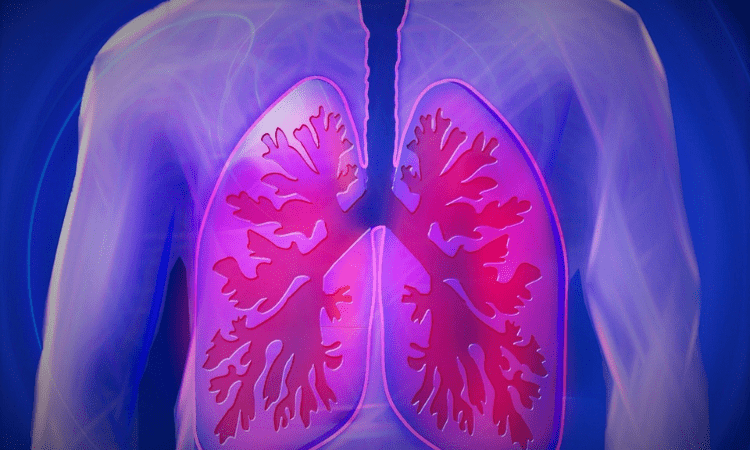 Lung cancer  stimulate in the non-smoking humans than air pollution: Scientists