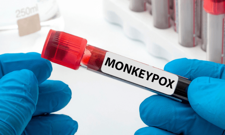 New Zealand confirms 1st two monkeypox cases of community transmission
