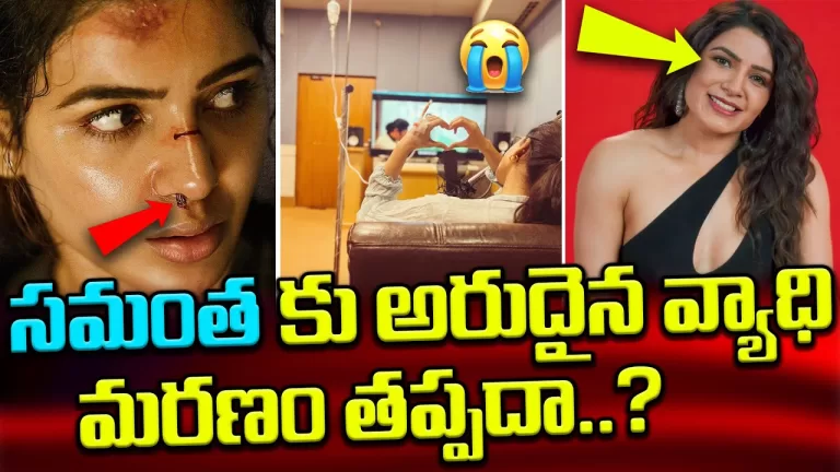What Happened To Samantha Health.? | Real Facts about Samantha Health Situation | Telugu Bullet