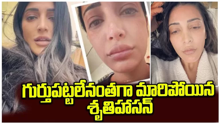 Shruti Hassan Without Makeup Pics Goes Viral | What Happens To Actress Shruti Hassan | Telugu Bullet