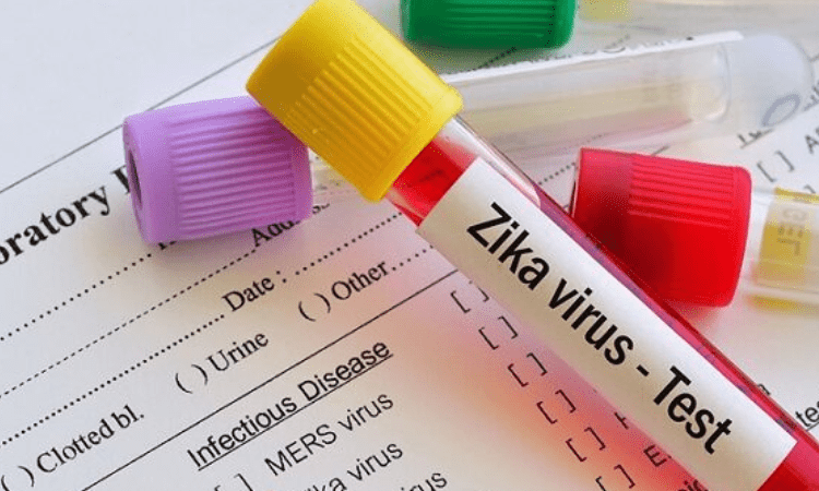 K’taka on alert as first case of Zika virus surfaces