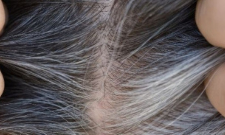 why our hairs turn grey