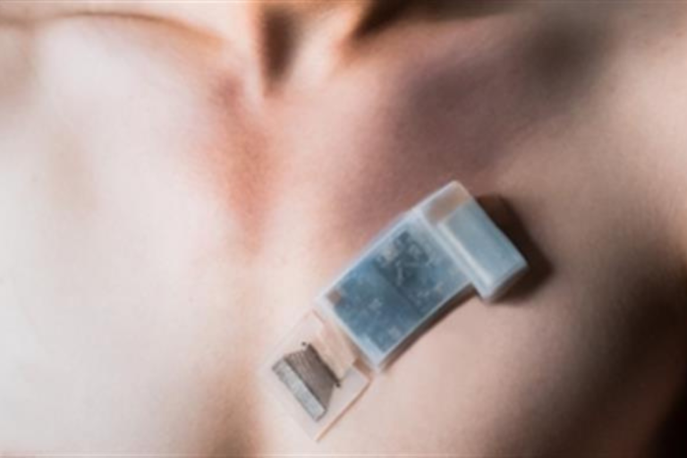 New wearable ultrasound system can monitor BP