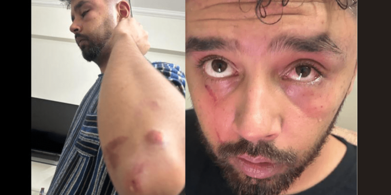 Gautam Sawang’s Son Involved in Altercation with Youth